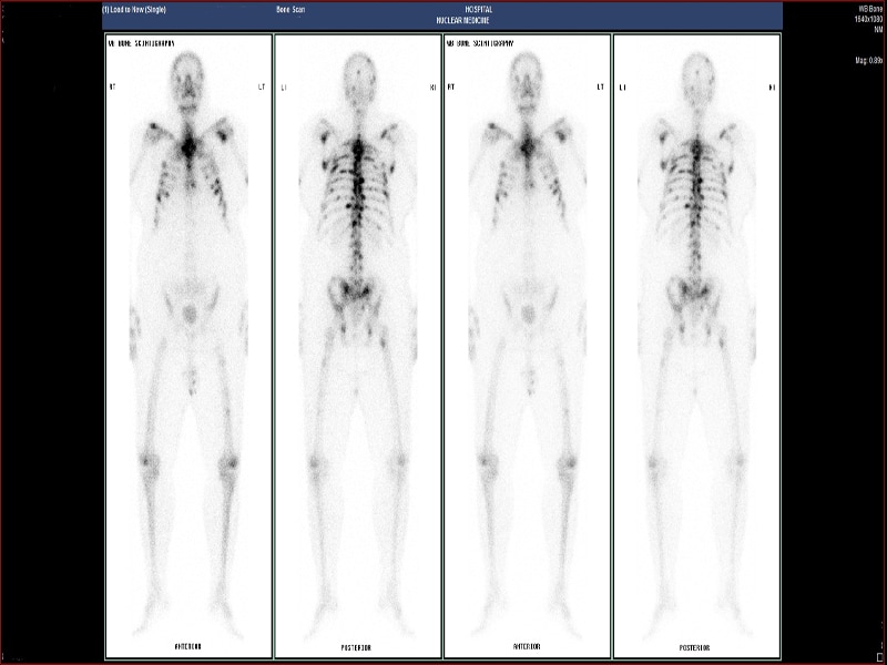 My cancer story | Paul Skyrme